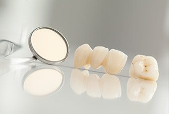 Custom dental crown and fixed bridge