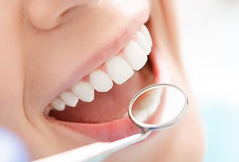 Closeup of smile during dental exam