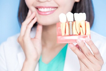 dentist holding model of dental implant between natural teeth