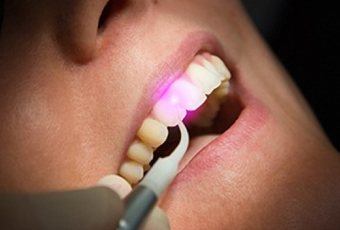 Your laser dentist in Ripon providing expert care. 