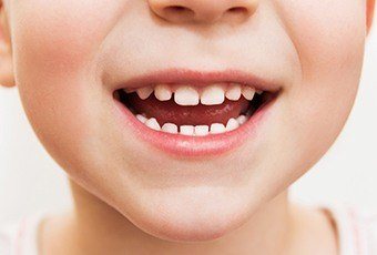 Closeup of child with healthy teeth