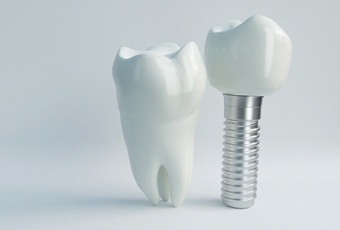 tooth and dental implant