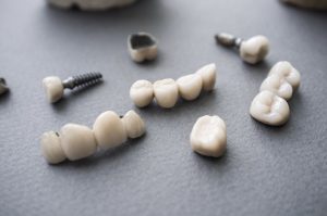 Dental restorations on a table.