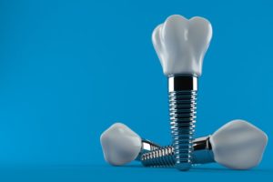 a computer illustration of dental implants against a blue background