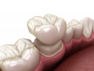 dental crown 3D illustration