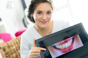 dentist pointing to an enhanced smile on a tablet
