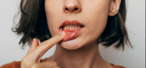 Woman pulling down lip to show signs of gum disease